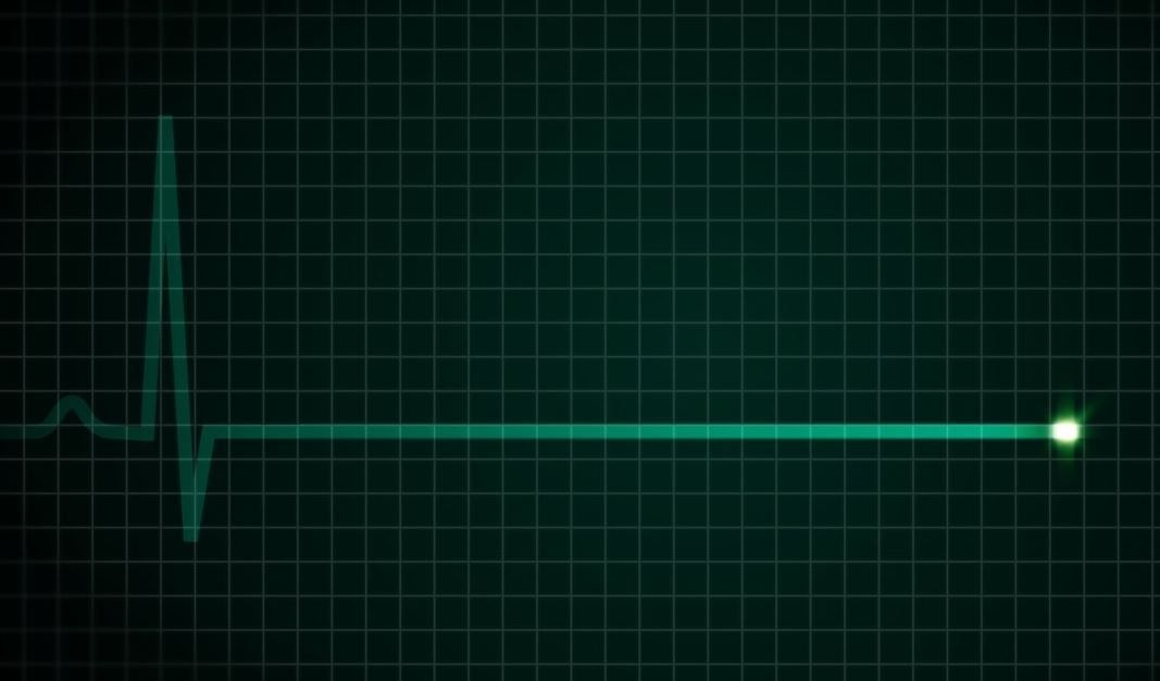 'O' öleceğimizi çok önceden biliyor! 16