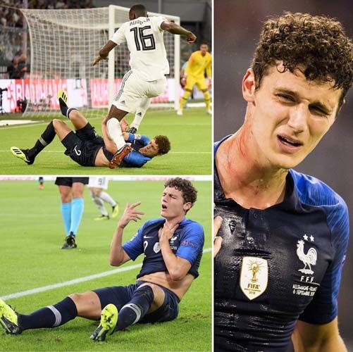 Fransız yıldızın boğazı parçalanacaktı! 3