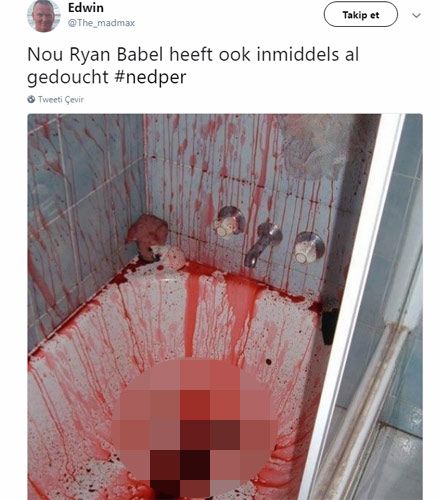 Beşiktaşlı yıldızla ilgili dehşete düşüren paylaşım! 2