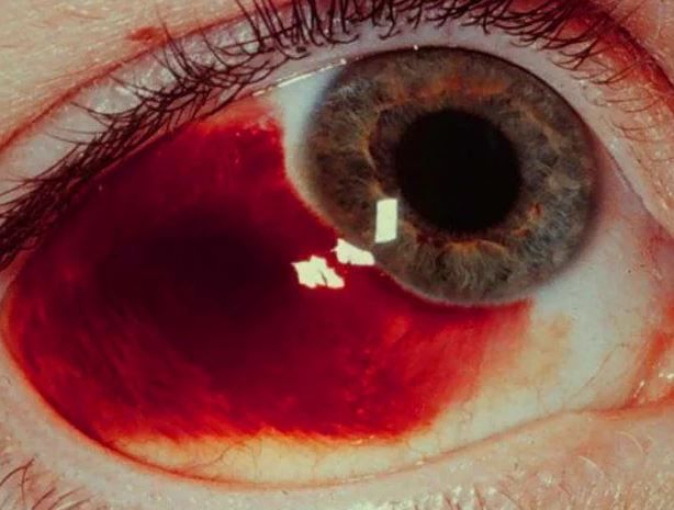 Doktorları tıp okuduğuna pişman eden hasta hikayeleri! 12