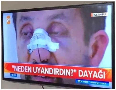 Yurdun dört yanından trajikomik kavga sebepleri! 2