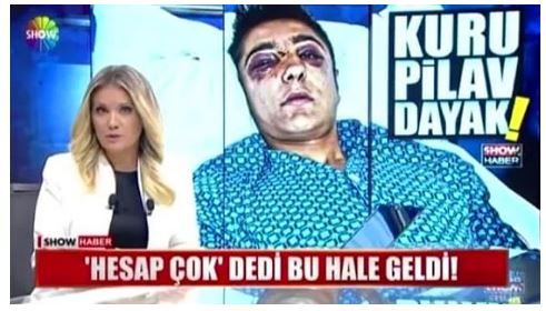Yurdun dört yanından trajikomik kavga sebepleri! 7