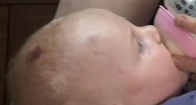Fedakar anneyi bu hale o getirdi! 7