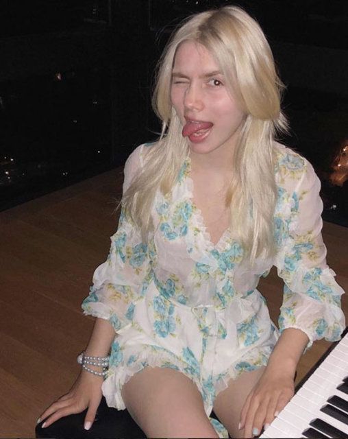 Aleyna Tilki'nin elleri direk dansı yapmaktan nasır tuttu! 13