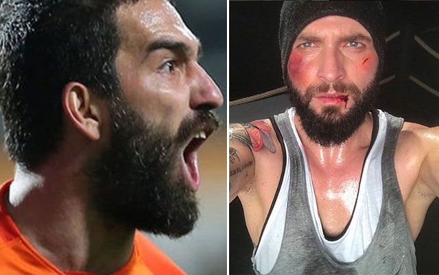 İşte olaylı geceden sonra Berkay'ın son hali! 1