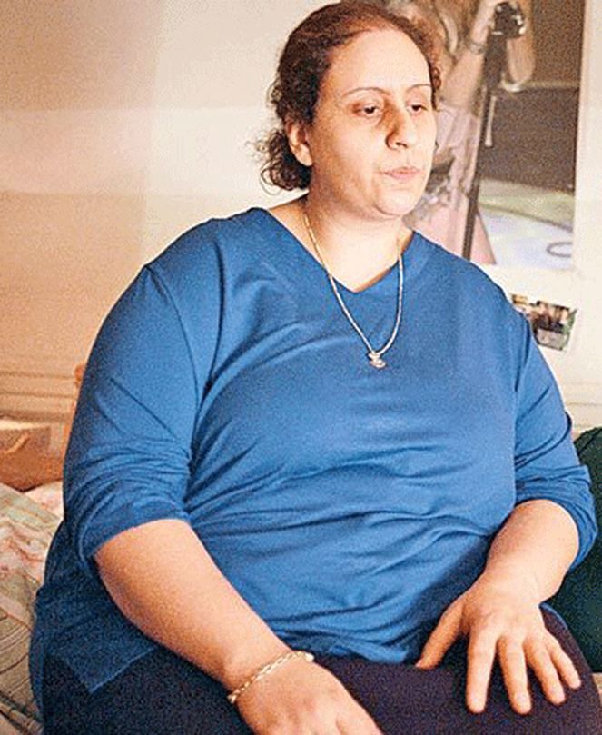 Zayıflayarak evrim geçiren ünlüler! 8