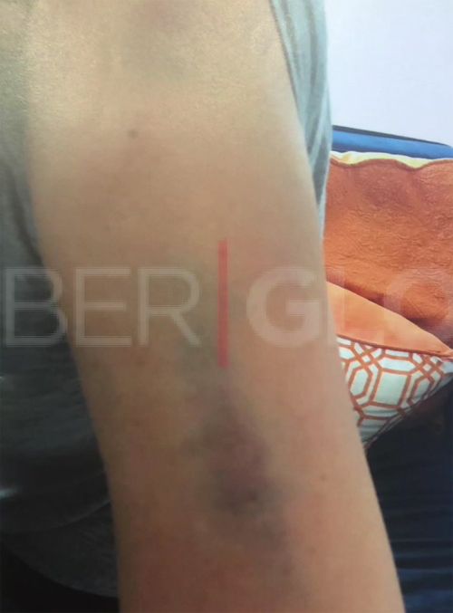 "Çok ciddi ruhsal problemleri var. Durup dururken parmağımı kırdı!" 12