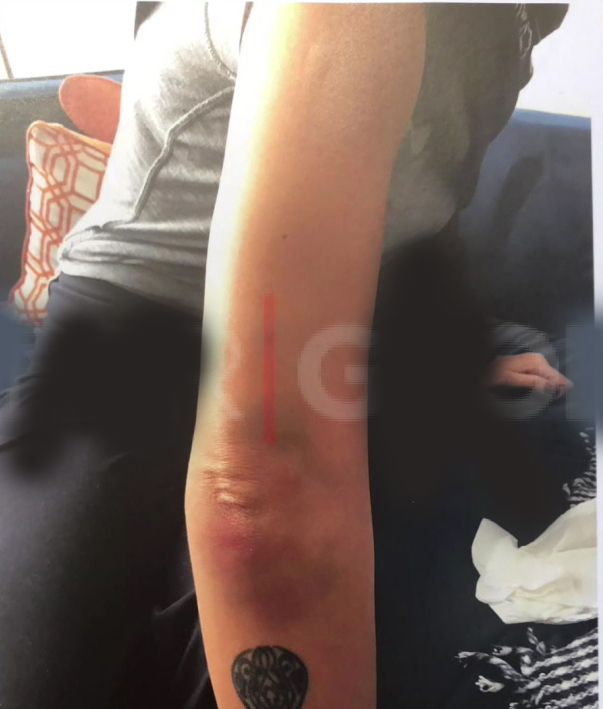 "Çok ciddi ruhsal problemleri var. Durup dururken parmağımı kırdı!" 14