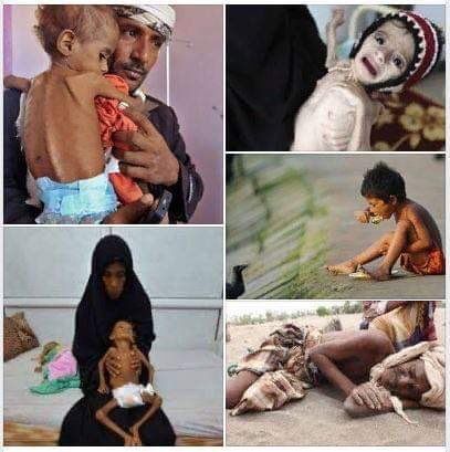 Türkiye Yemen'de ölen çocuklar için ayakta! 23