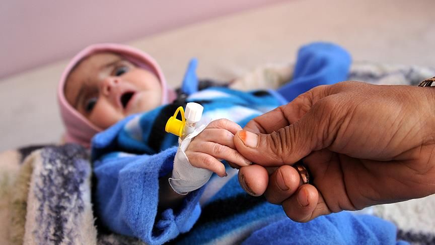 Türkiye Yemen'de ölen çocuklar için ayakta! 26