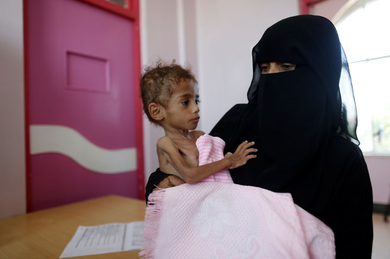 Türkiye Yemen'de ölen çocuklar için ayakta! 3
