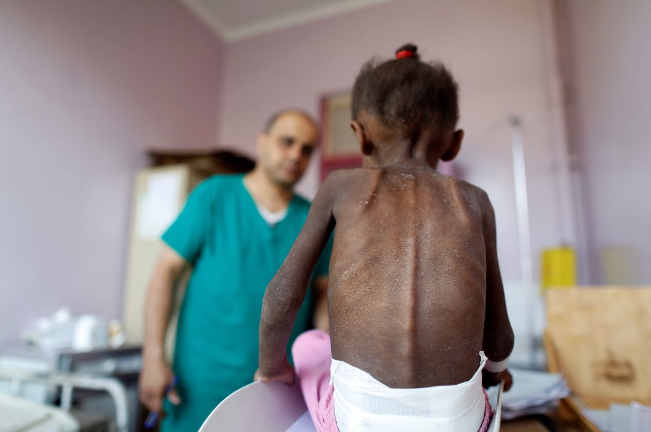 Türkiye Yemen'de ölen çocuklar için ayakta! 4