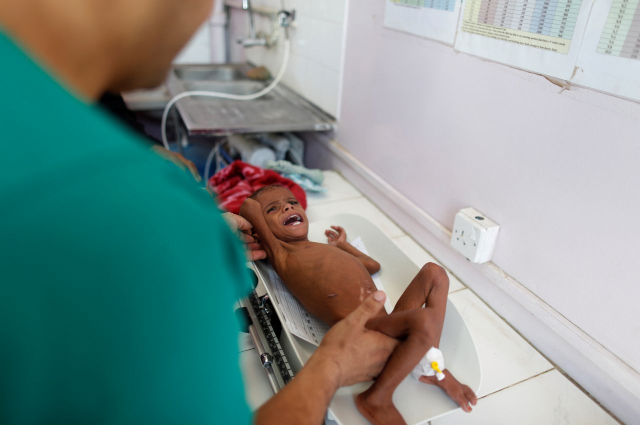 Türkiye Yemen'de ölen çocuklar için ayakta! 17