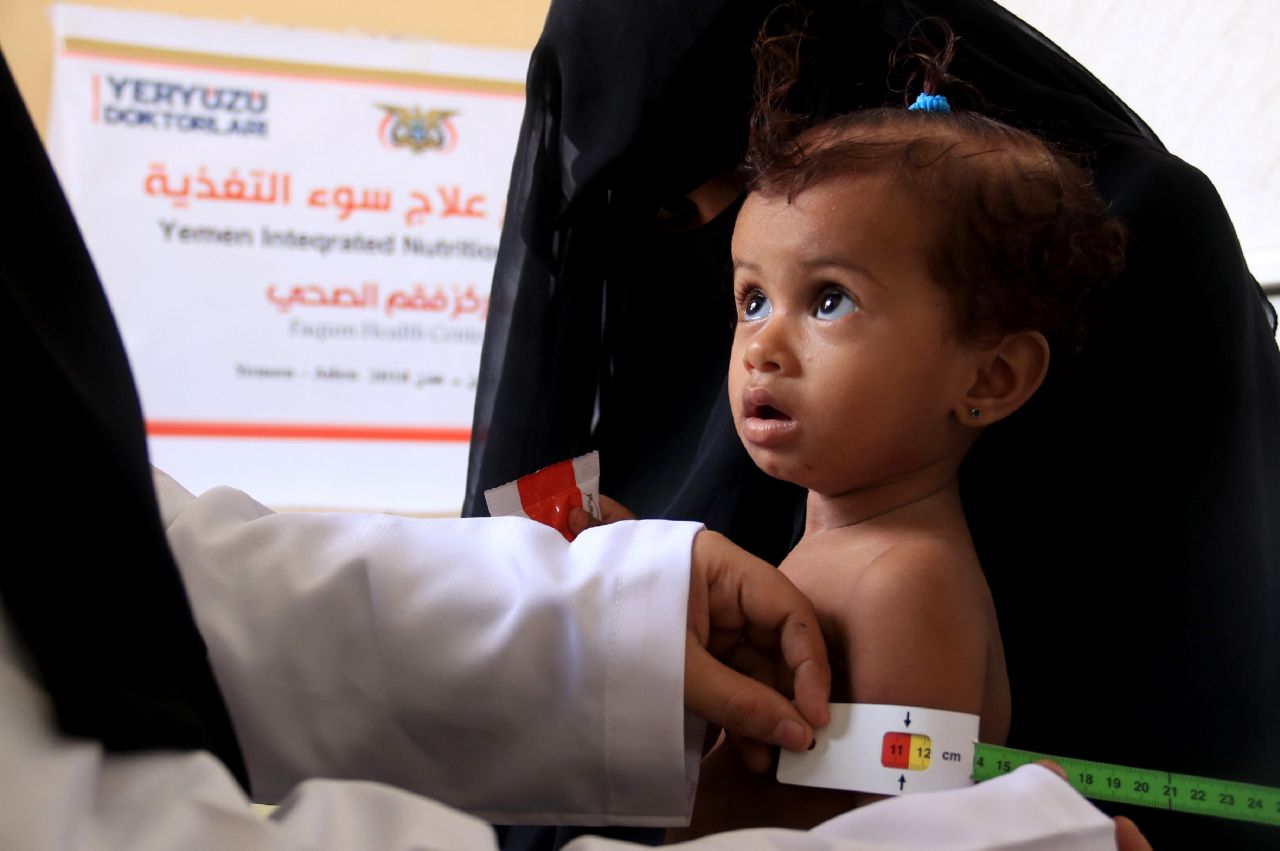 Türkiye Yemen'de ölen çocuklar için ayakta! 18