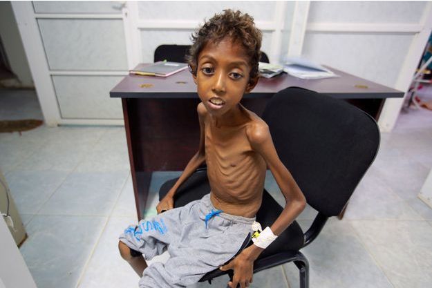 Türkiye Yemen'de ölen çocuklar için ayakta! 20