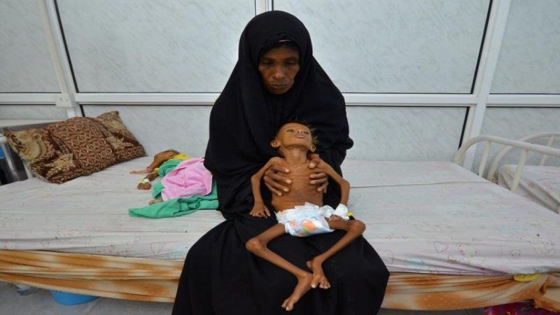 Türkiye Yemen'de ölen çocuklar için ayakta! 22