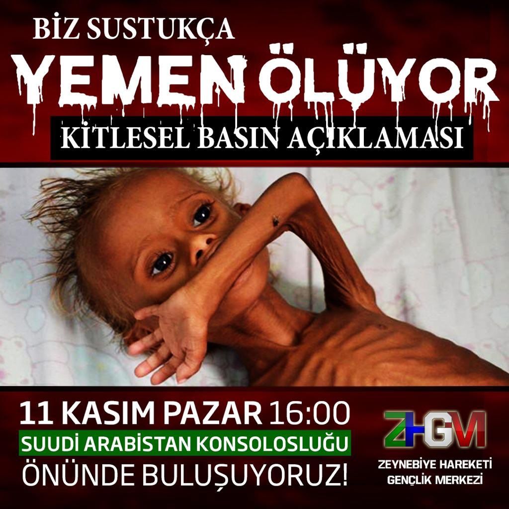 Türkiye Yemen'de ölen çocuklar için ayakta! 1