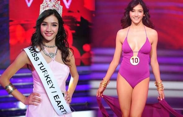 Balerinken sakatlandı bir yarışma ile ünlü oldu! 5