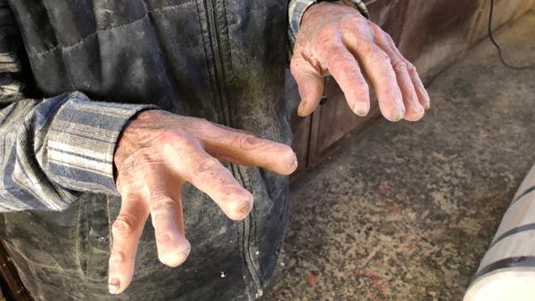 72 yıllık mesleği ellerini bu hale getirdi! 5
