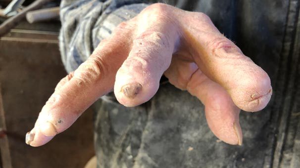 72 yıllık mesleği ellerini bu hale getirdi! 6