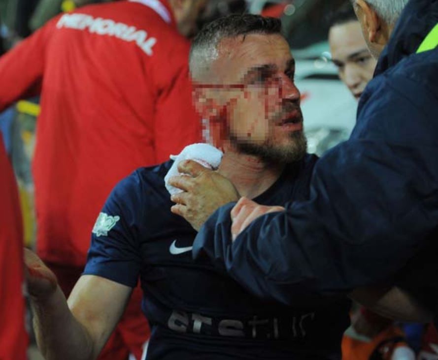 Antalya'da korkutan sakatlık! 5
