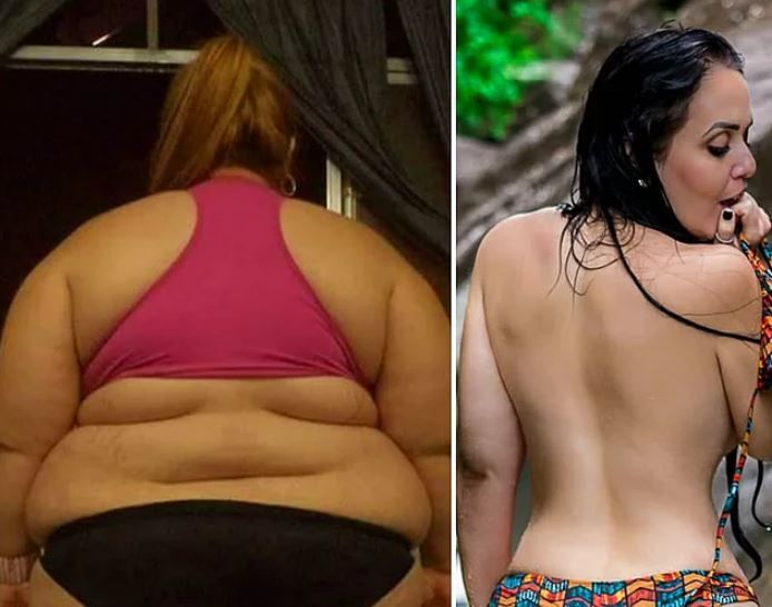 92 kilo vererek ölümün kıyısından döndü! 5