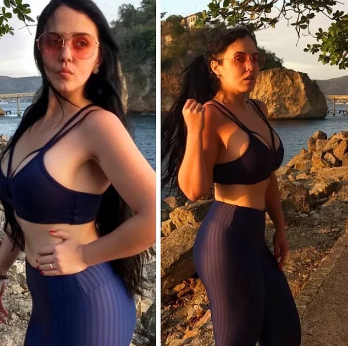 92 kilo vererek ölümün kıyısından döndü! 8