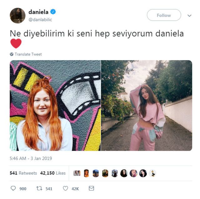 Danla Bilic ameliyat sonrası eridi! 2