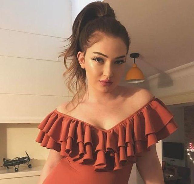 Danla Bilic ameliyat sonrası eridi! 15