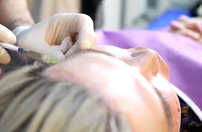 'Ken Bebek' 62'nci estetiğini yaptırdı! 7