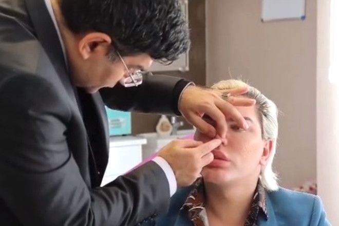 'Ken Bebek' 62'nci estetiğini yaptırdı! 2