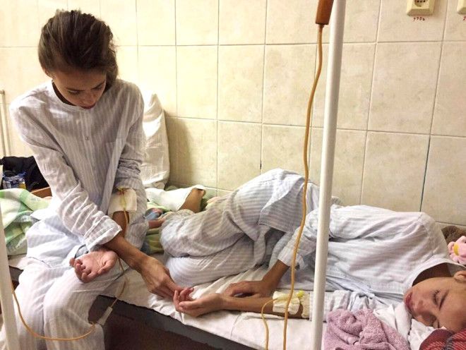 Manken ikizler, zayıflamalarını isteyen ajans yüzünden ölümden döndü! 3