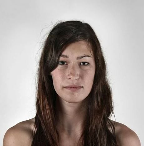 Bu fotoğrafı görenler onu hasta sanıyor! 16