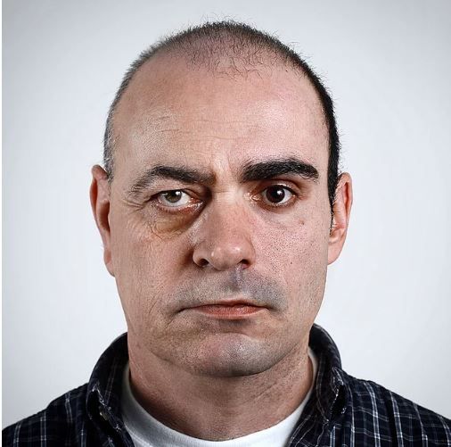 Bu fotoğrafı görenler onu hasta sanıyor! 20
