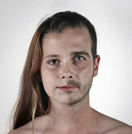 Bu fotoğrafı görenler onu hasta sanıyor! 7