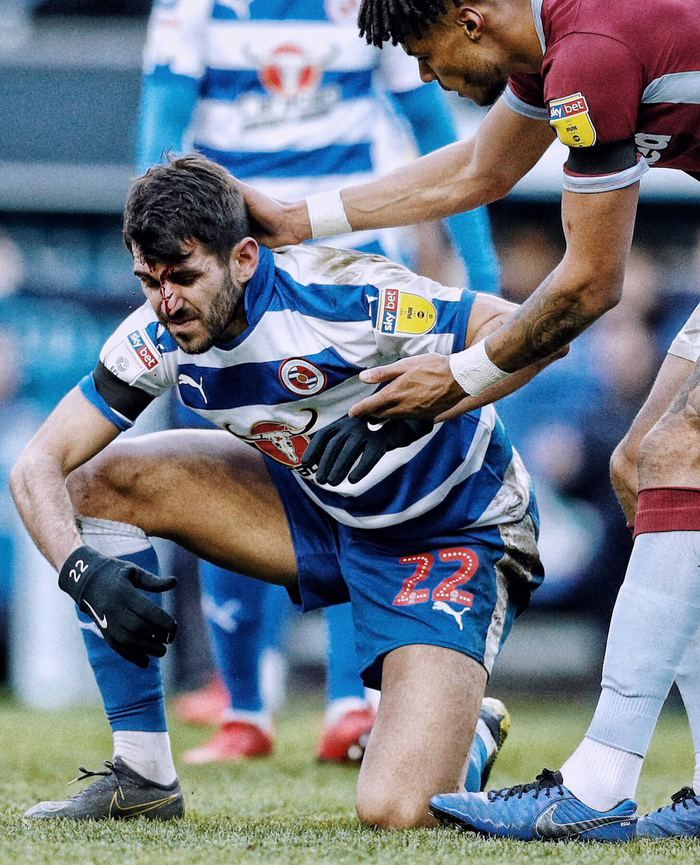 Korkunç sakatlık! Tanınmaz hale geldi... 5