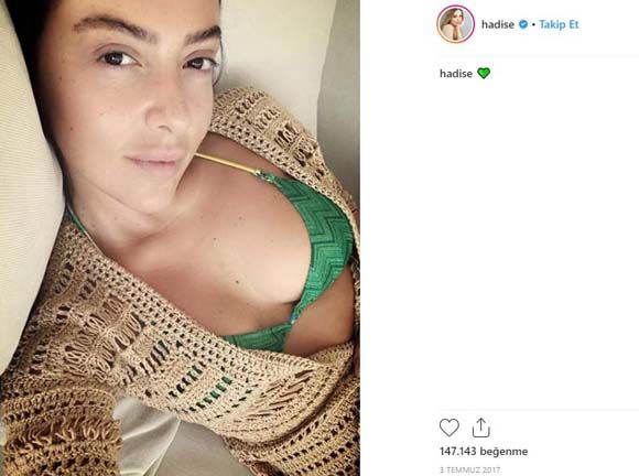 Hadise çıldırdı! Murat Boz ve Aslı Enver... 3