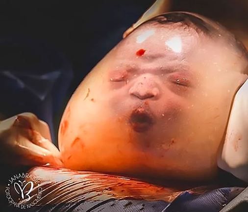 Bu bebeğin doğumunu görenler dehşete düşüyor! 1