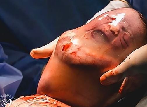 Bu bebeğin doğumunu görenler dehşete düşüyor! 4
