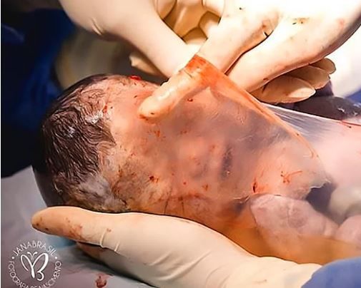 Bu bebeğin doğumunu görenler dehşete düşüyor! 5