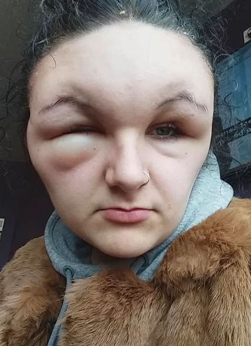 Güzelleşmek isterken az daha canından oluyordu! 1