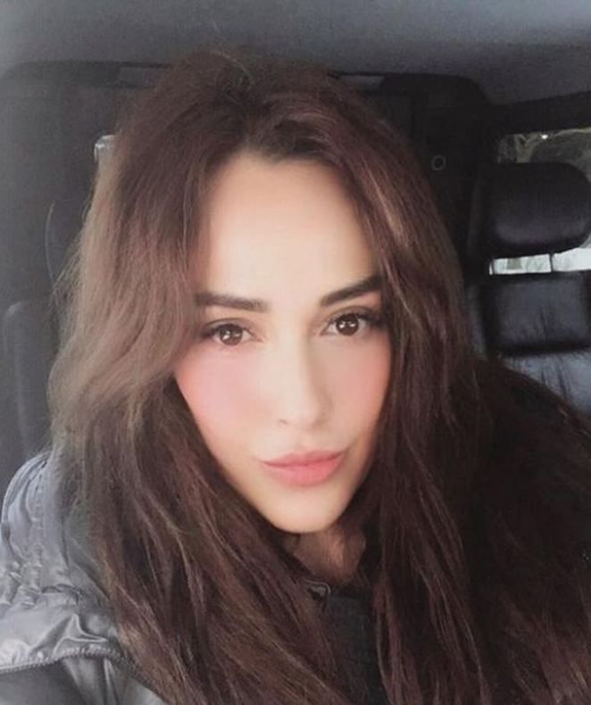 Güzelleşmek isterken Aslıhan Doğan oldu! 2