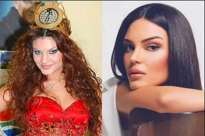 Almeda Abazi'den 'estetik' isyanı! 6