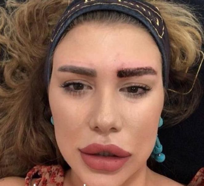 Kısmetse Olur Melis alay konusu oldu! 2