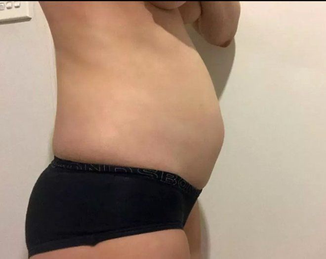 Güzel modelin karnı bir anda şişti! 4