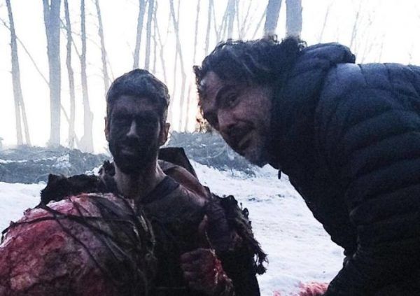 Genetik hastalığından dolayı filmlerin aranan yüzü oldu! 8