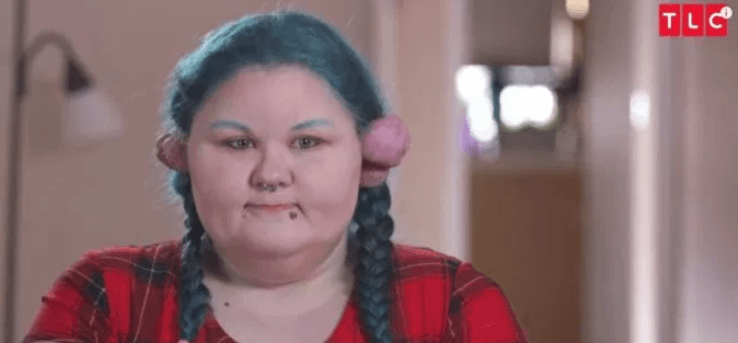 Piercing taktırdığı için kulağı bu hale geldi! 1