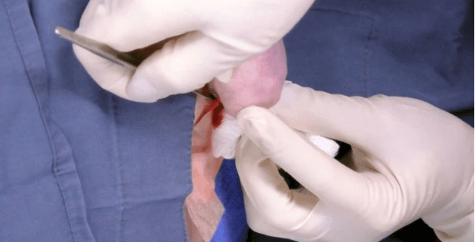 Piercing taktırdığı için kulağı bu hale geldi! 4