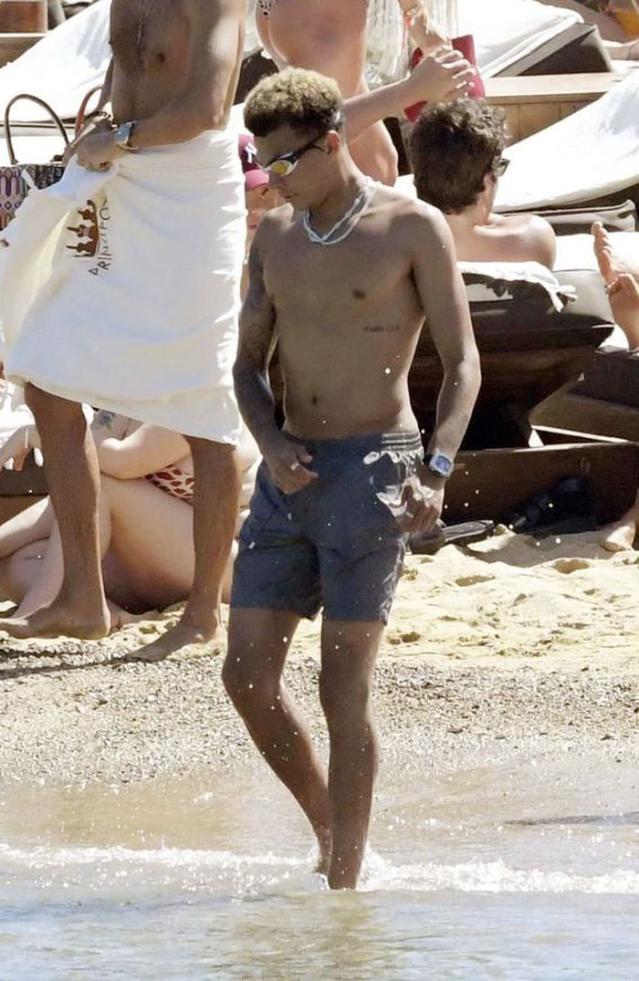 Dele Alli korkuttu! 18