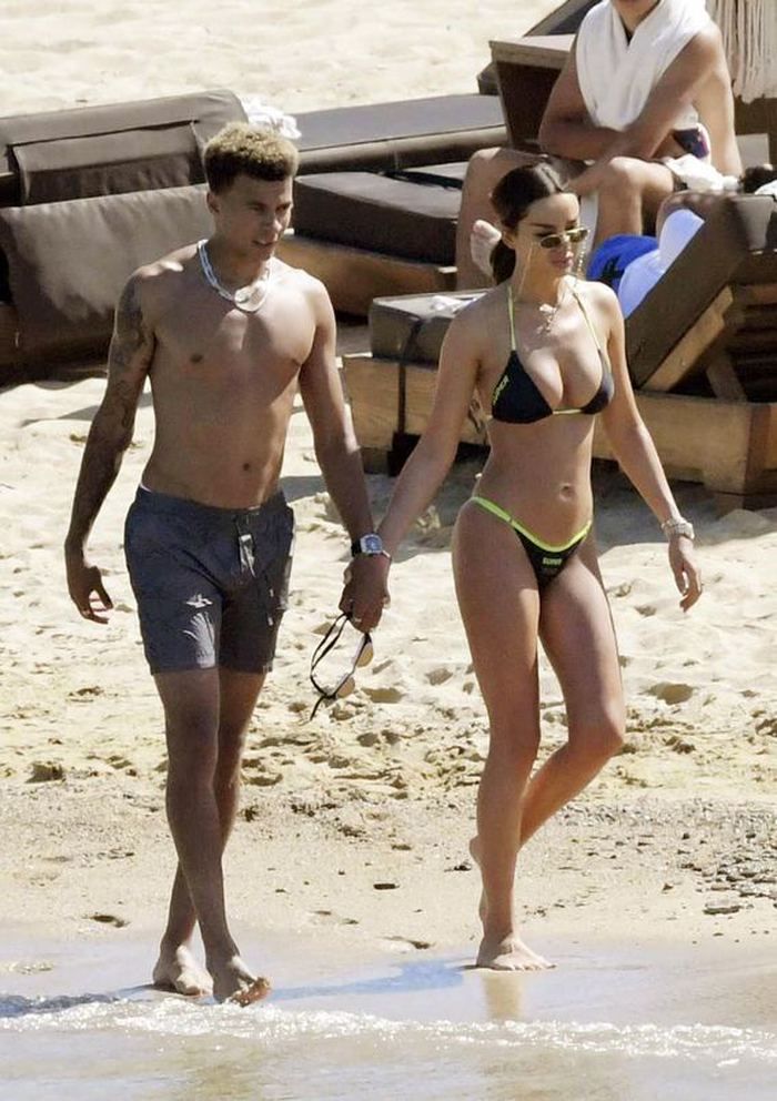 Dele Alli korkuttu! 1